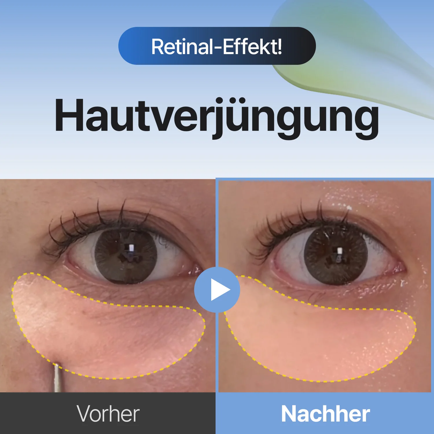 [Amazon Nr. 1] Retinal Skin Booster Serum – Falten- & Fleckenpflege - Image 2