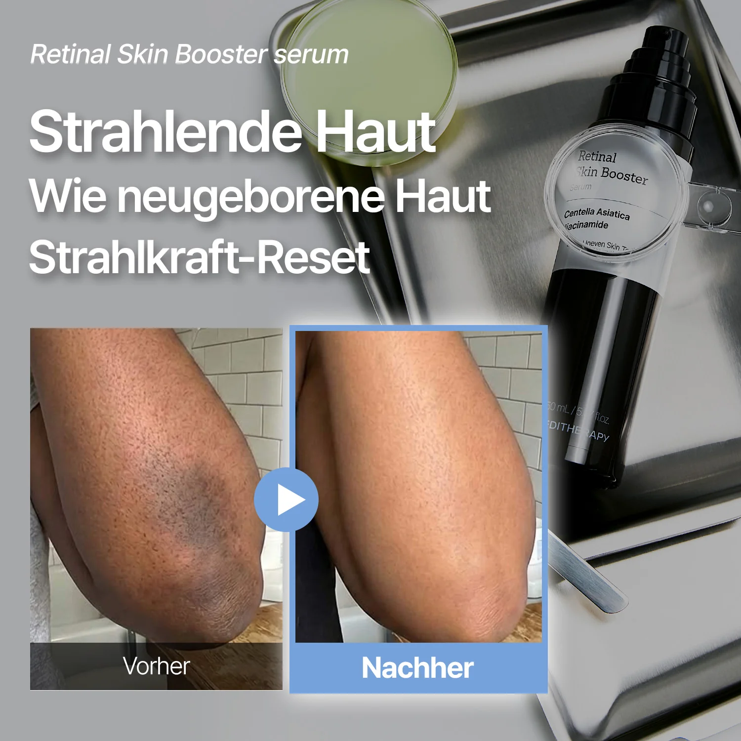 [Amazon Nr. 1] Retinal Skin Booster Serum – Falten- & Fleckenpflege - Image 3