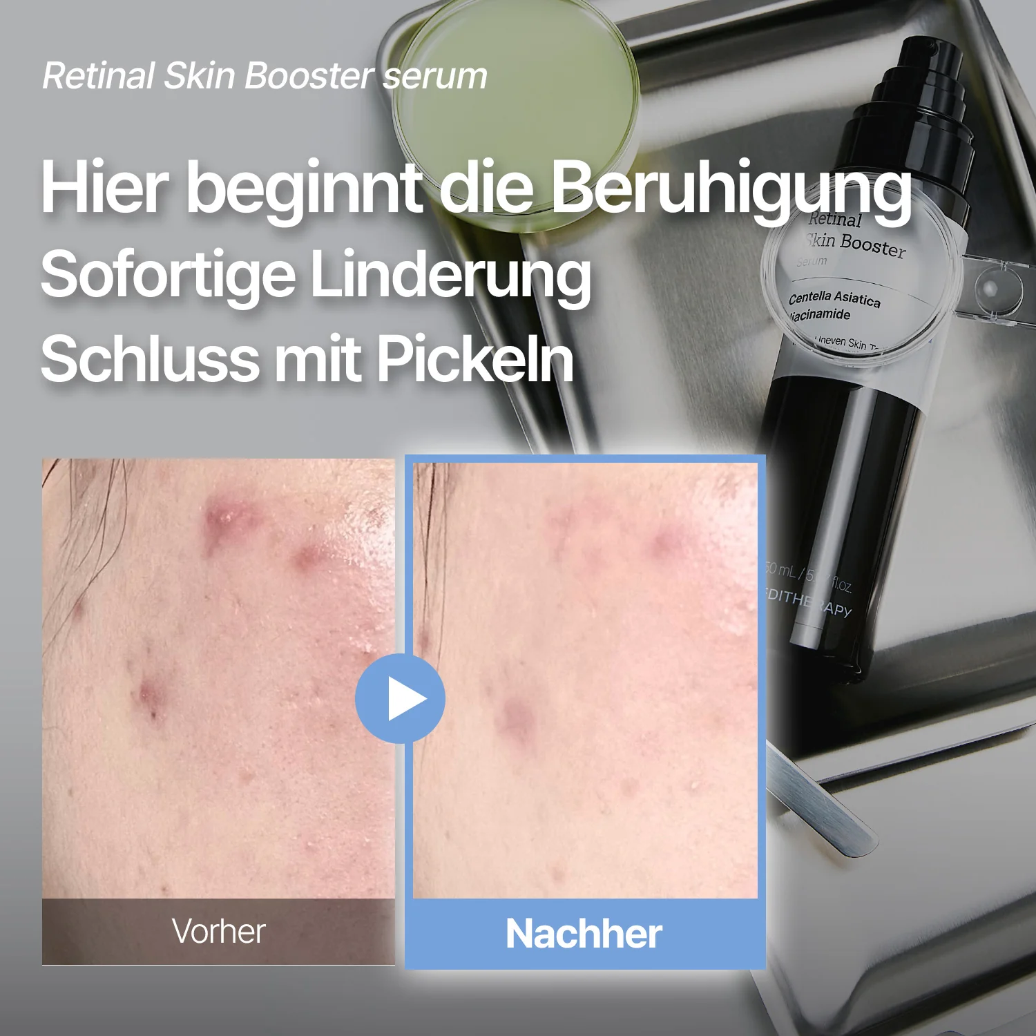 [Amazon Nr. 1] Retinal Skin Booster Serum – Falten- & Fleckenpflege - Image 4