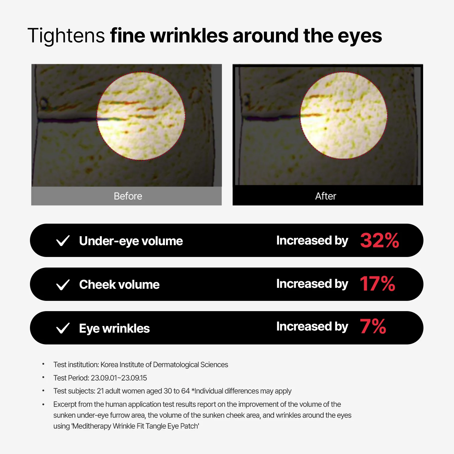 [56% OFF/$9.99] Wrinkle-Fit Tangle Eye Patch – Lowest Price Ever - Image 4