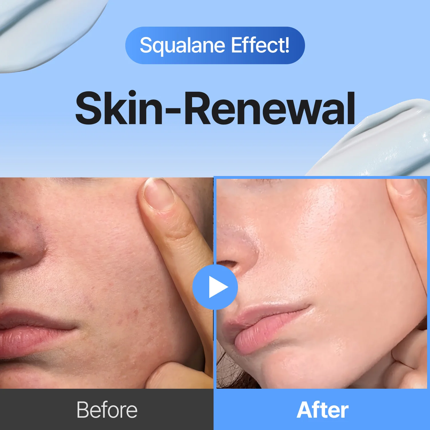 3-Step Korean Glass Skin Trio — Retinal, Hyaluronic Acid & Squalane Moisturizer - Image 4