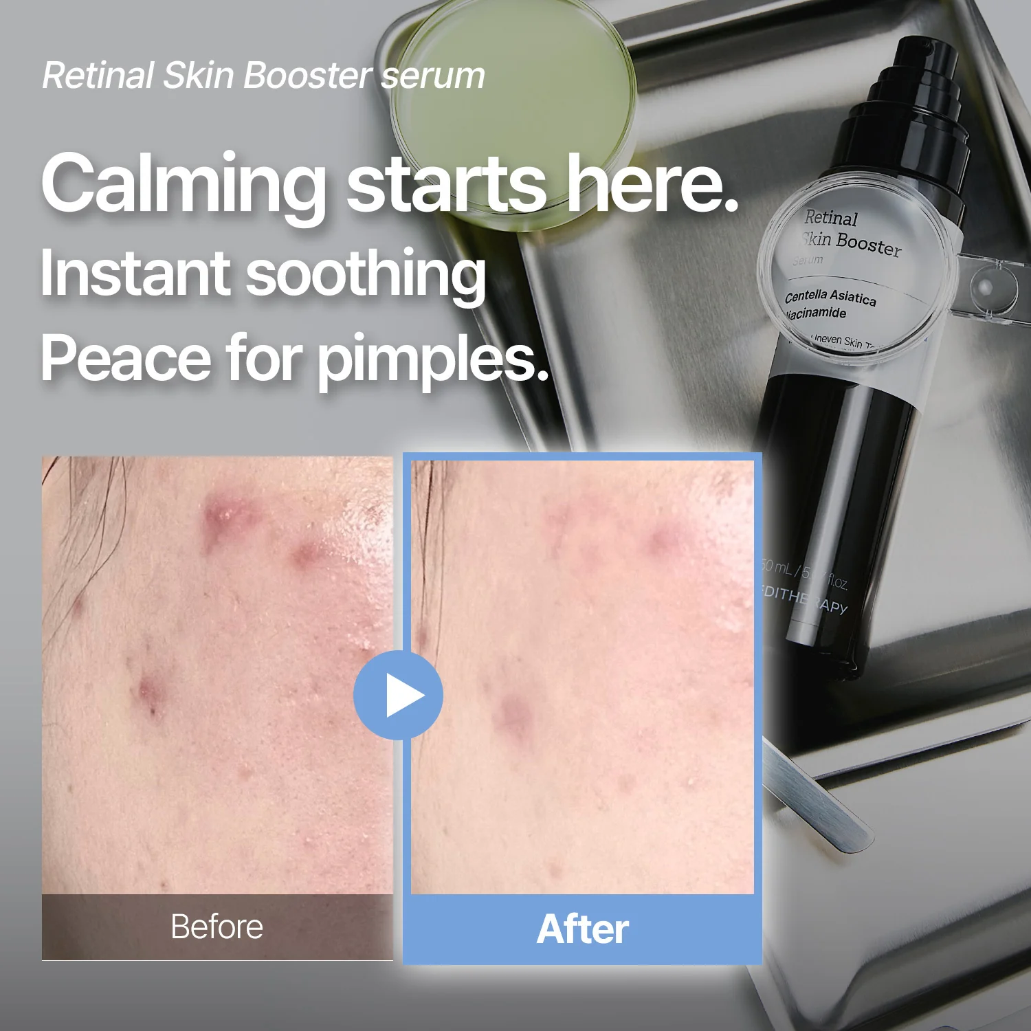 [Amazon #1]Retinal Skin Booster Serum - Dark Spot & Wrinkle care - Image 4