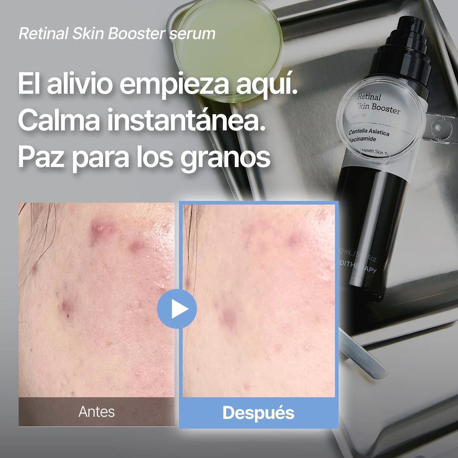 [Amazon n.º 1]Retinal Skin Booster Serum -Antimanchas y antiarrugas - Image 4