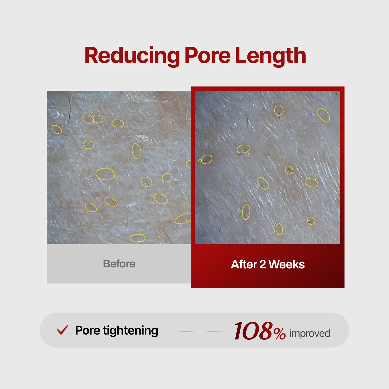 Wrinkle-fit Mask (hidden) - Image 10