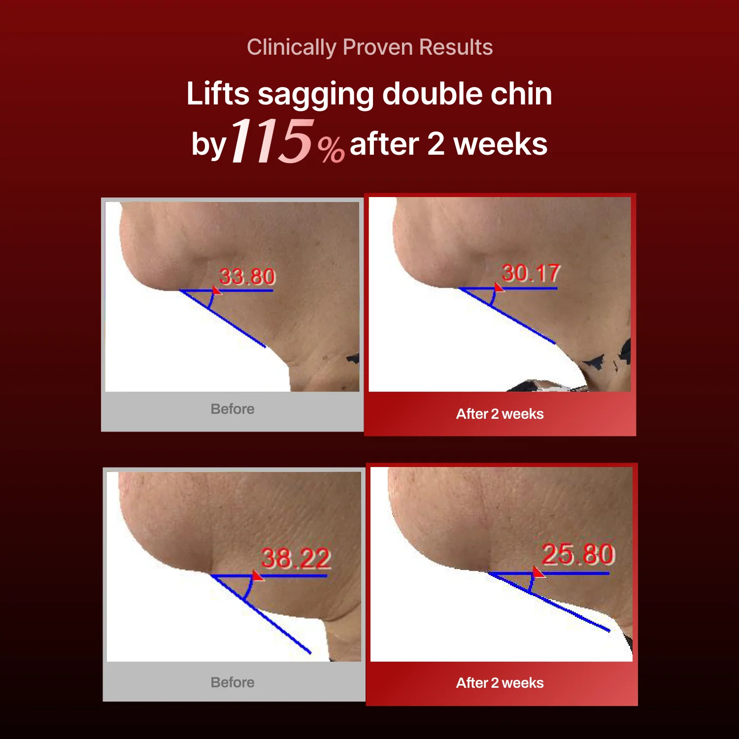 Wrinkle-fit Mask (hidden) - Image 11