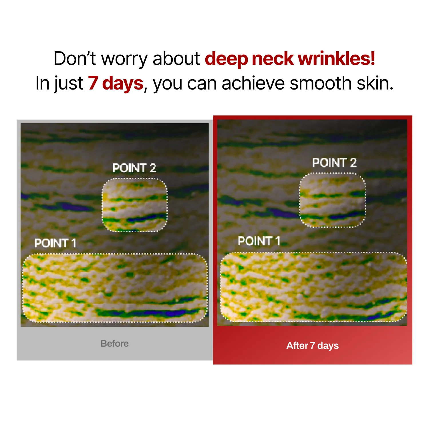 Wrinkle-fit Mask (hidden) - Image 13