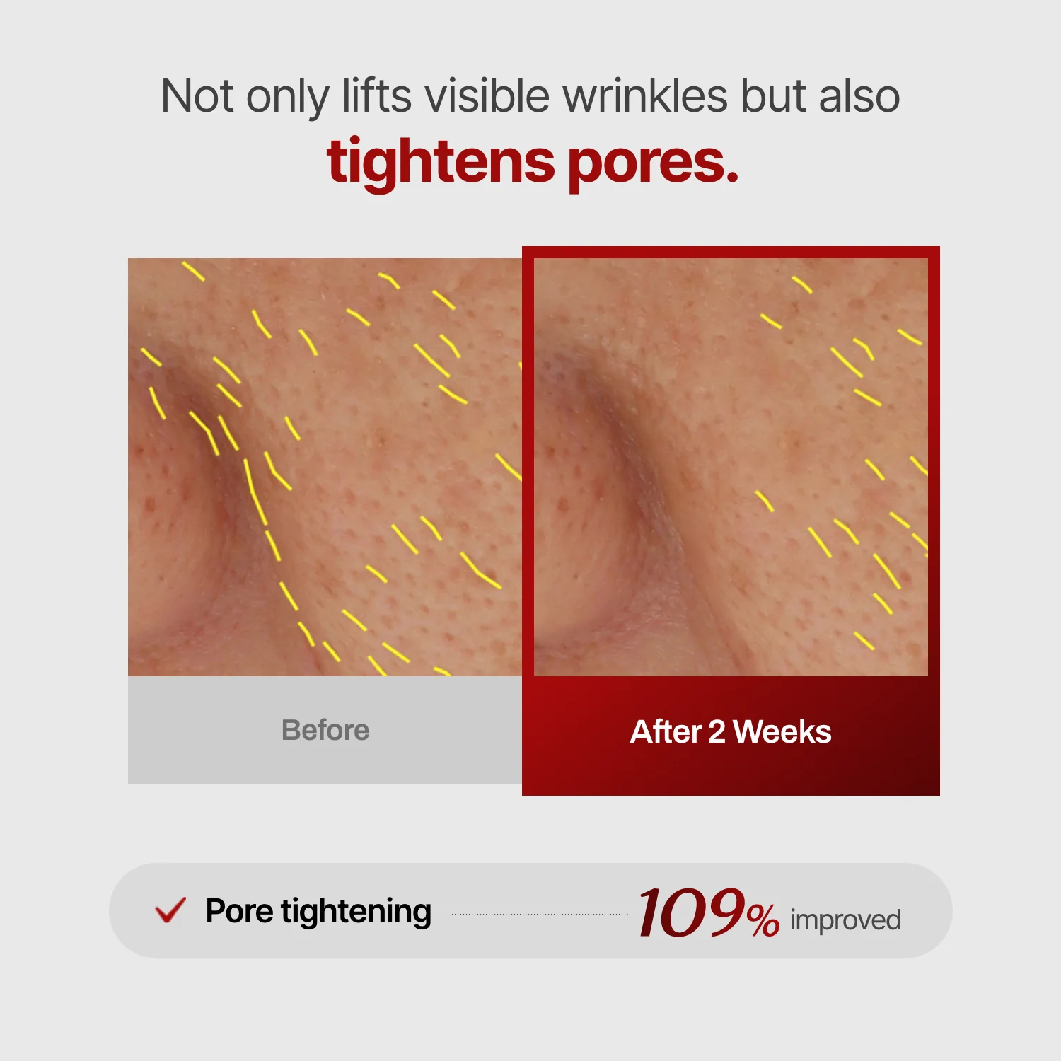 Wrinkle-fit Mask (hidden) - Image 9